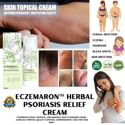 Eczemaron Anti Fungal Sprau | Buy 1 Get 1 Free