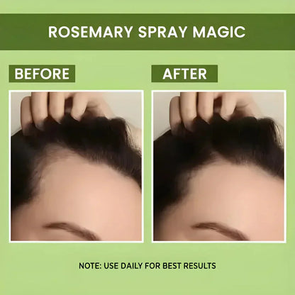 Rosemary Water Hair Elixir (Buy 1 Get 2 Free)